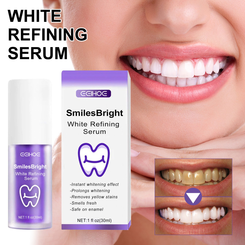 Teeth Whitening In Korea - 歯のクリーニング ホワイトニング歯磨き粉 ホワイトニングジェル ホワイトナー ブリーチ 汚れを除去