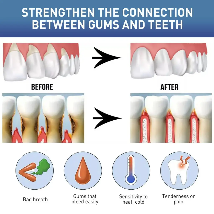 60ML 天然口腔ケア液 歯の不快感を和らげる 健康な歯茎を - Teeth Whitening Naturally のレビューと価格