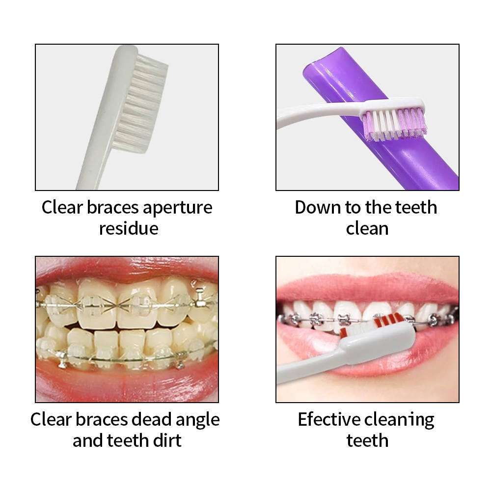 8 ピース/セット矯正歯科ケアブラシキット歯クリーニングブレ - Teeth Whitening Brush のレビューと価格
