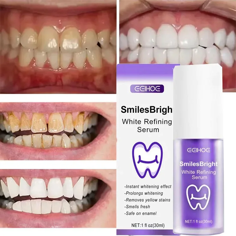 歯のクリーニング ホワイトニング歯磨き粉 ホワイトニングジェ - Teeth Whitening In Korea のレビューと価格