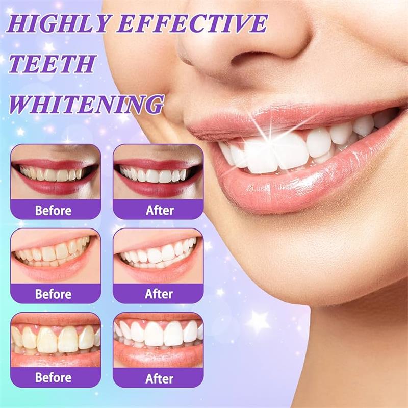 9D パープル歯磨き粉ムース 黄ばんだ歯の汚れ除去用集中ステ - Teeth Whitening Naturally のレビューと価格