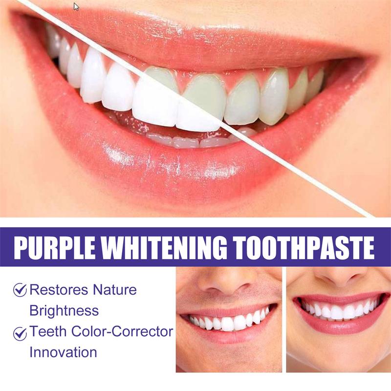 9D パープル歯磨き粉ムース 黄ばんだ歯の汚れ除去用集中ステ - Teeth Whitening Naturally のレビューと価格