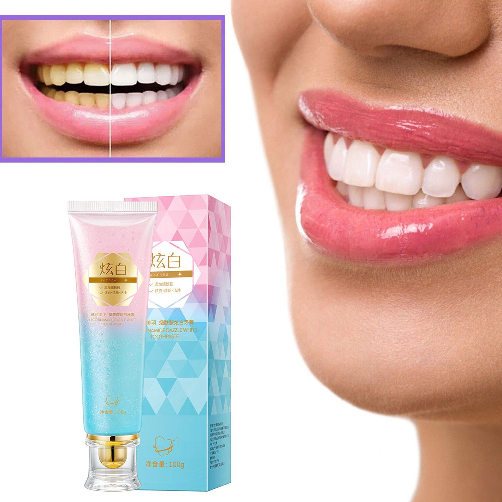 ナイアシンアミド美白歯磨き粉口腔ケア口臭汚れ除去歯垢を減らす - Teeth Whitening Treatment のレビューと価格