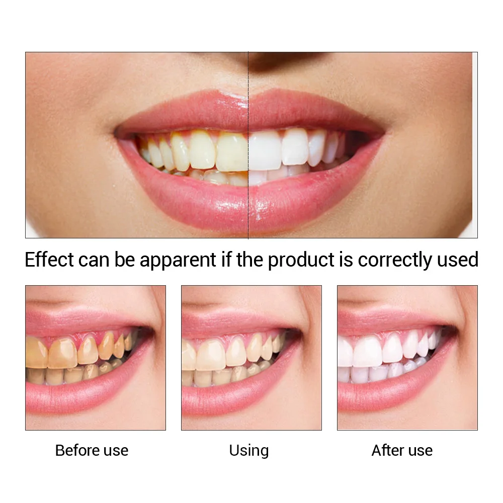 歯のホワイトニングエッセンス,口腔衛生,歯のホワイトニング, - Teeth Whitening Near Me のレビューと価格