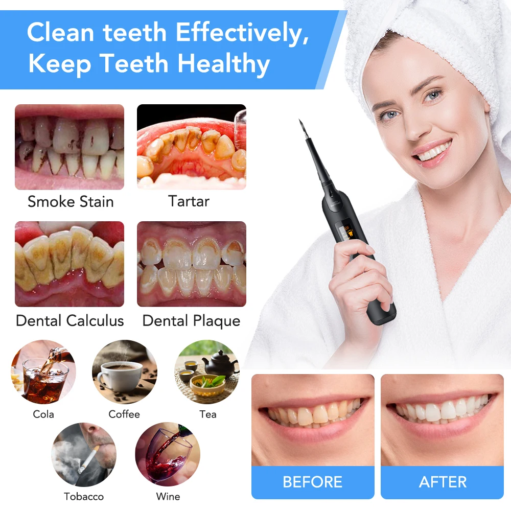 電動歯科スケーラー歯ブラシセット液晶画面 LED ライト歯科 - Teeth Whitening Toothbrush のレビューと価格