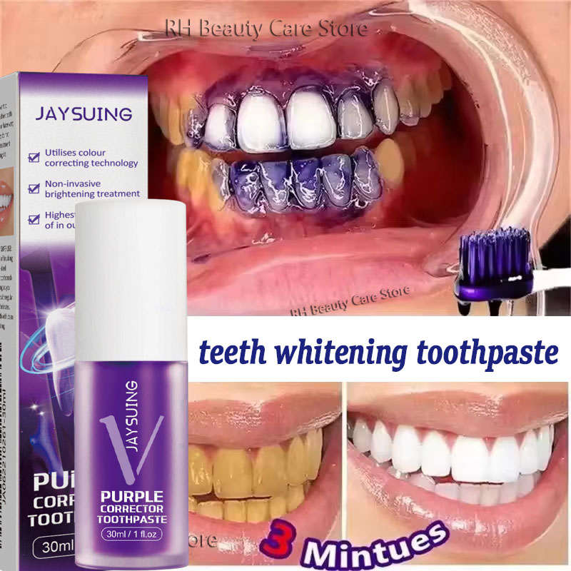 歯のホワイトニング歯磨き粉、ホワイトニングジェル、ホワイトナ - Teeth Whitening In Korea のレビューと価格
