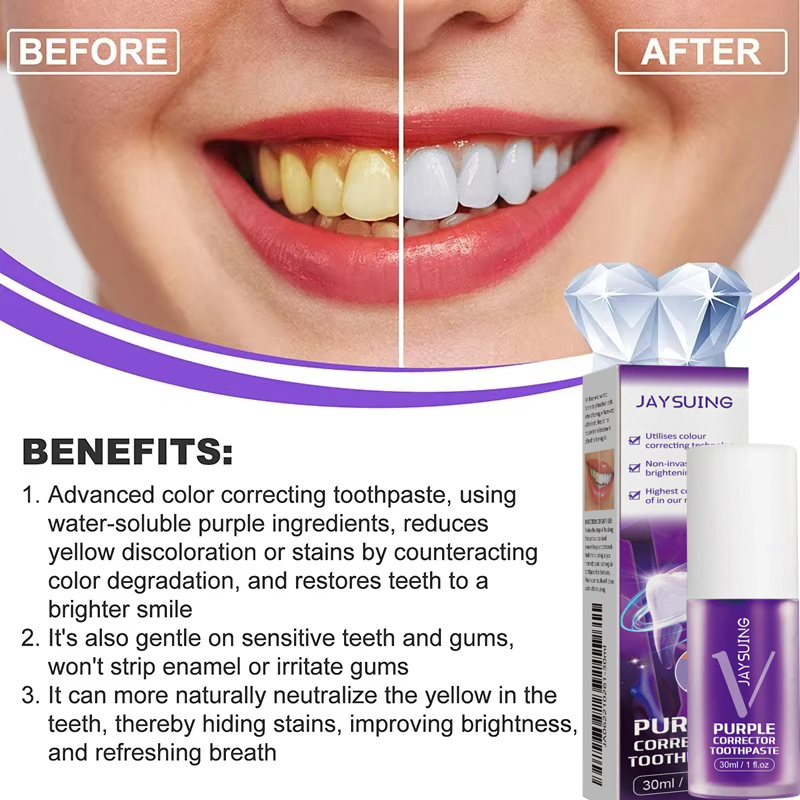 歯のホワイトニング歯磨き粉、ホワイトニングジェル、ホワイトナ - Teeth Whitening In Korea のレビューと価格